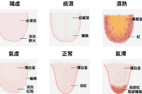 八分鐘學會中醫舌相、體質、情緒、食療